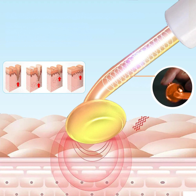 DermaPulse | Professionel Hudopstramning og Aknebehandling hjemmefra