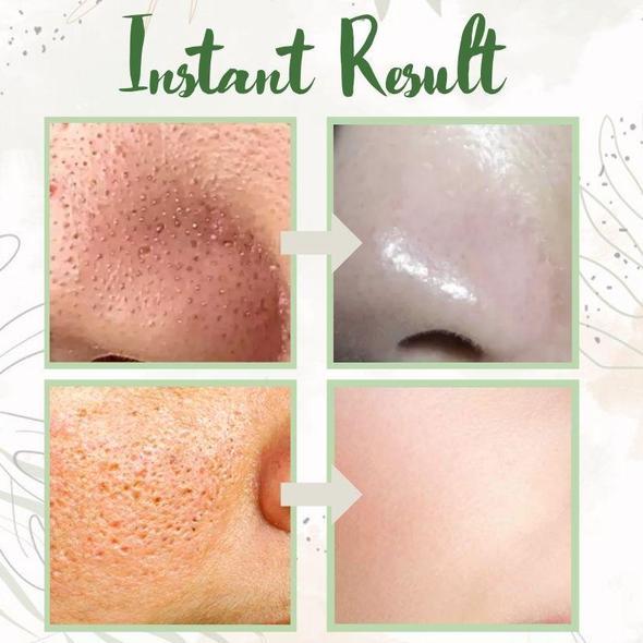 Bellezza | Ansigt Maske – Dybderensende Te til Strålende Hud 3