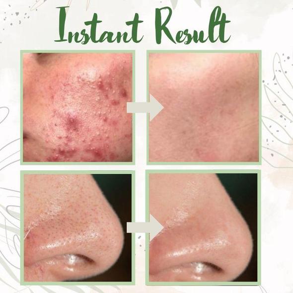 Bellezza | Ansigt Maske – Dybderensende Te til Strålende Hud 4