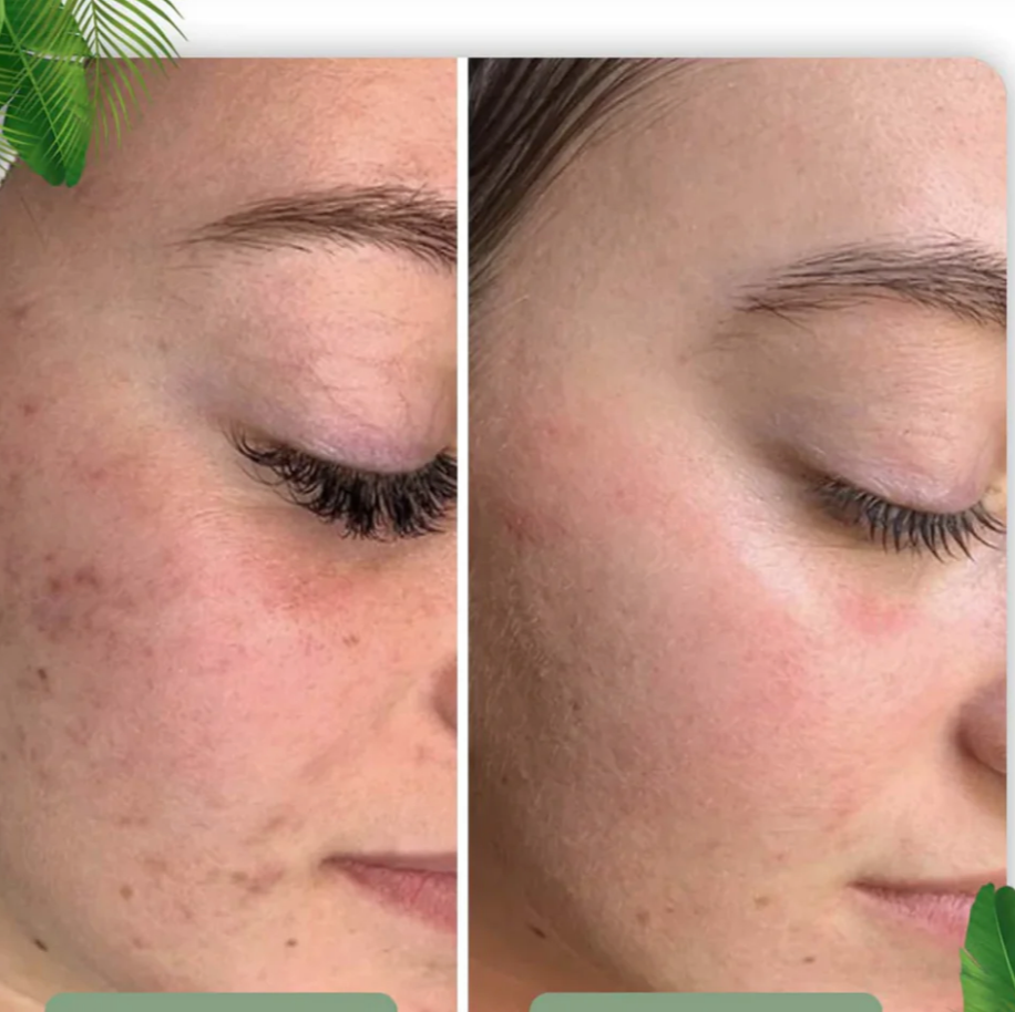 Grøn Te Ekstrakt Ansigtsmaske Stick - Dybderensning og Poreminimering-3