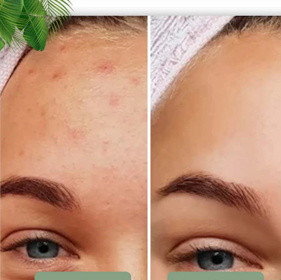 Grøn Te Ekstrakt Ansigtsmaske Stick - Dybderensning og Poreminimering-6