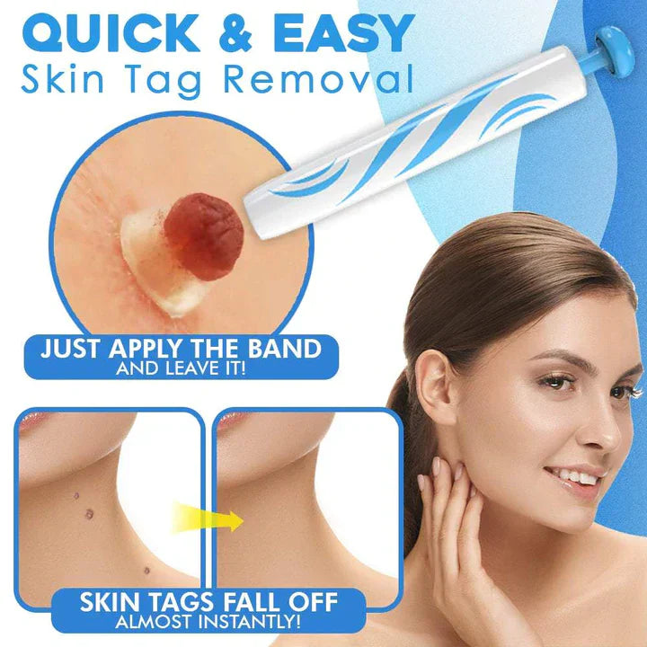 Bellezza | Skin Tag Removal Kit – Effortless Skin Perfection 2
