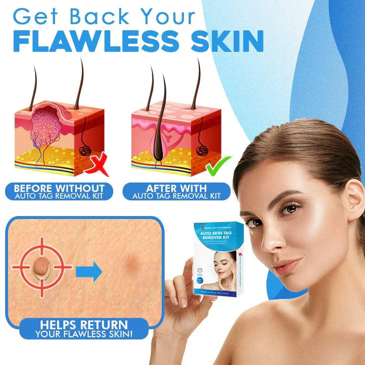 Bellezza | Skin Tag Removal Kit – Effortless Skin Perfection 3