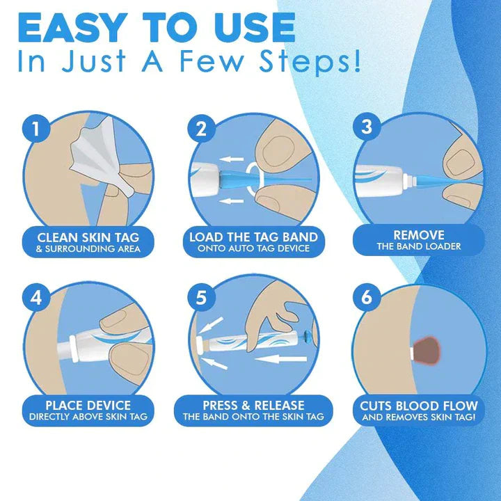 Bellezza | Skin Tag Removal Kit – Effortless Skin Perfection 5