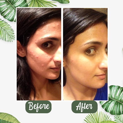 GlowPur | Dybderensende Ansigtsmaske med Grøn Te Nuvenci.dk