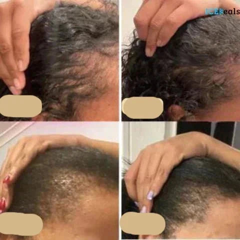 Vegansk Hårolie - Naturlig Olie Til Hår Med Grøn Kaffe Og Arganolie-6