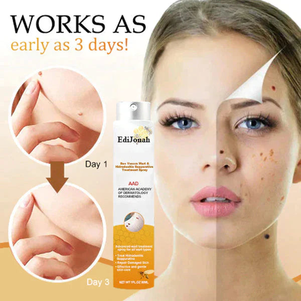 SkinClear | Vortefjerner Spray – Skånsom og Effektiv Behandling