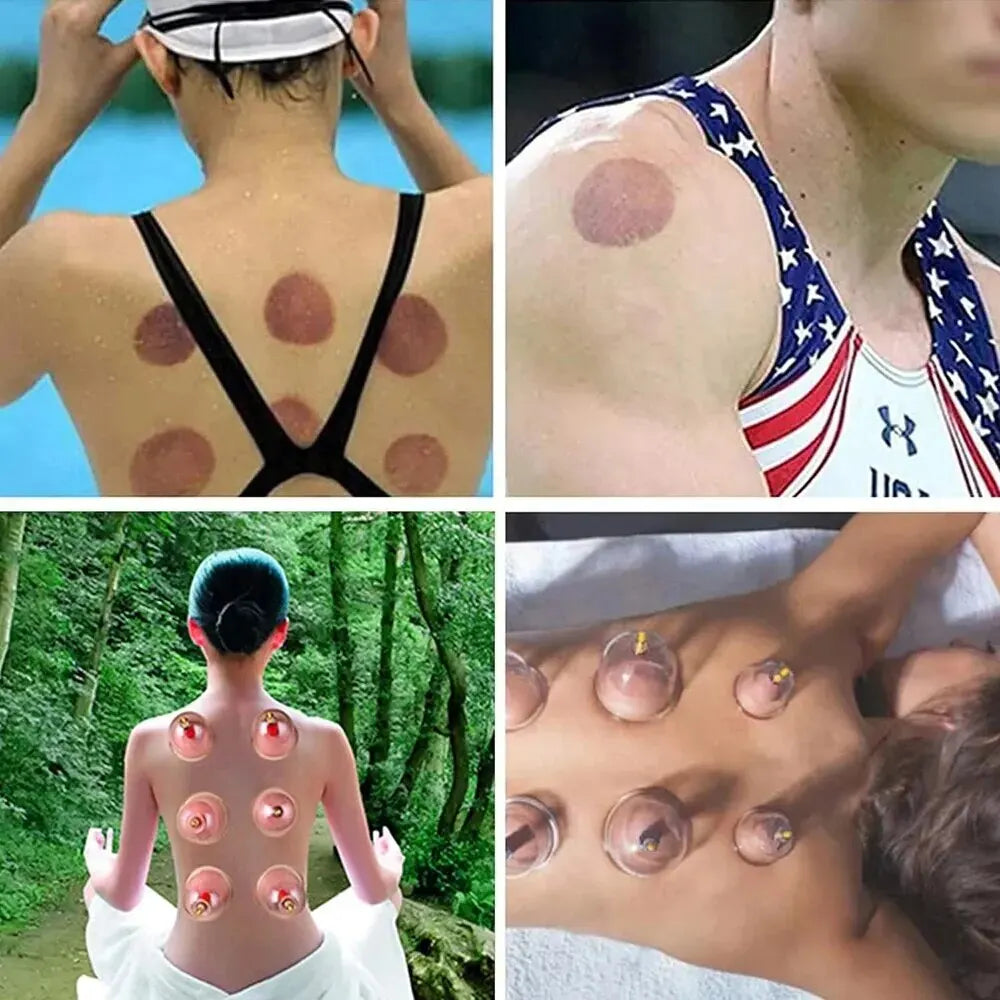 VitalCups | Vakuum Cupping – Hurtig Lindring af Ømme Muskler
