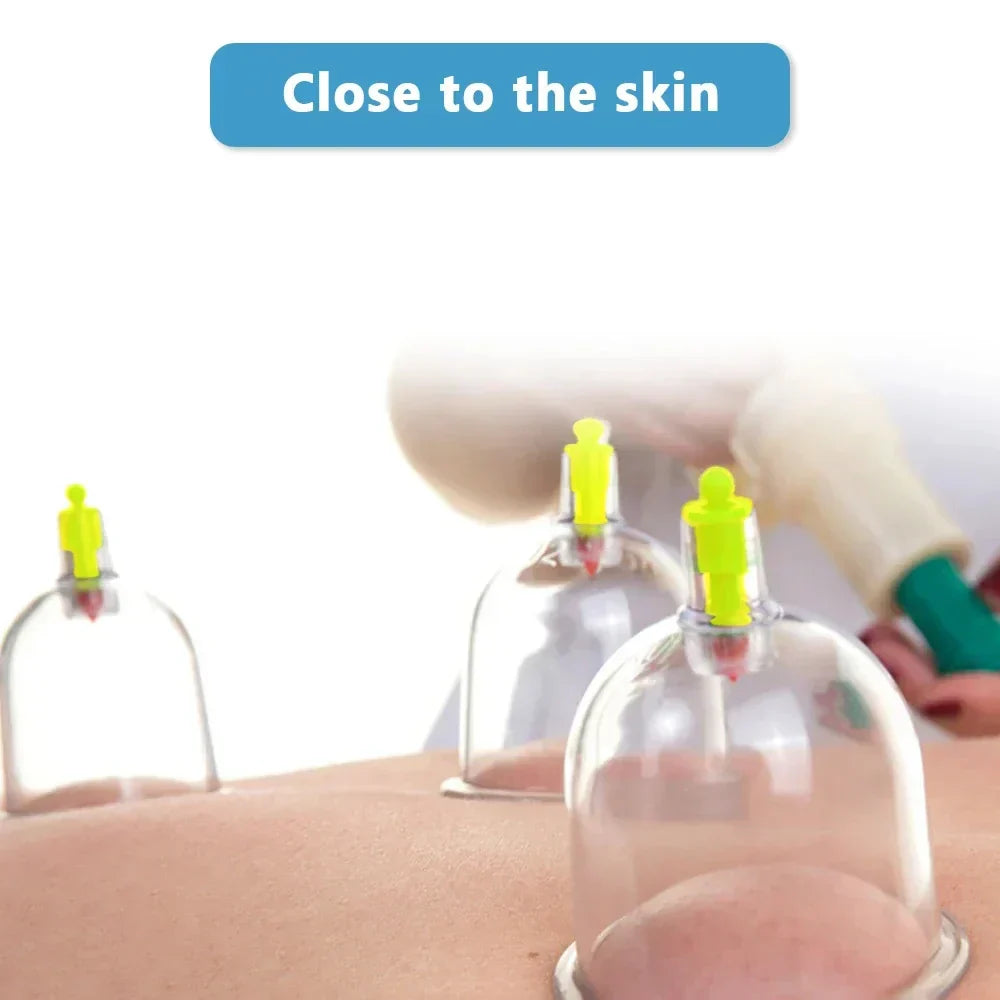 VitalCups | Vakuum Cupping – Hurtig Lindring af Ømme Muskler