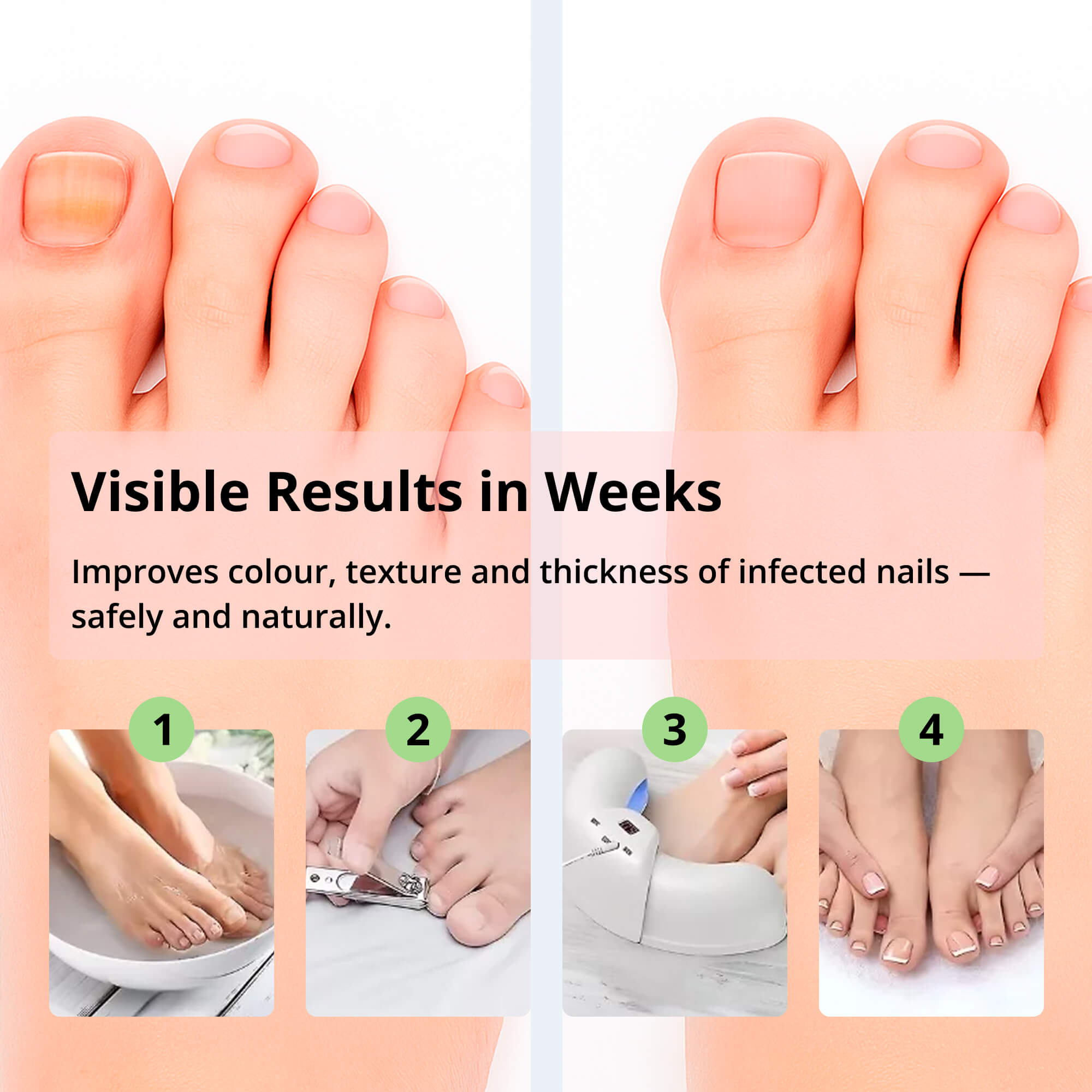 ClearToe | Neglebehandling – Sundere og Smukkere Negle Hurtigt