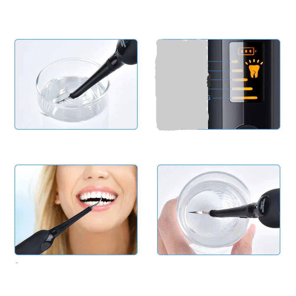 OralShine | Hjemmerensning af Tænder