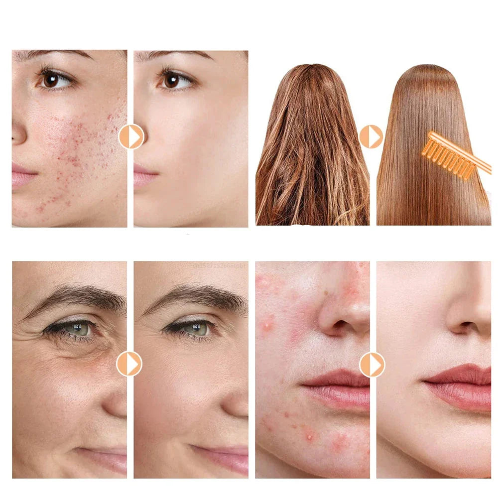 DermaPulse | Professionel Hudopstramning og Aknebehandling hjemmefra