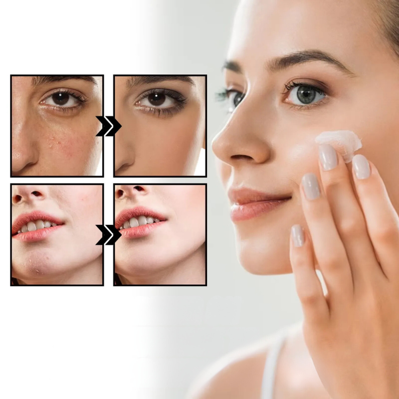 AuriSkin | Plejende Creme til Rosacea og Følsom Hud Nuvenci.dk