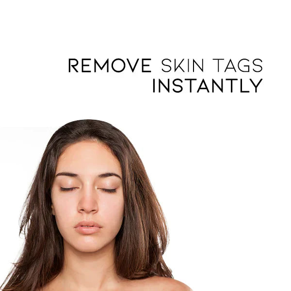 SkinClear | Vortefjerner Spray – Skånsom og Effektiv Behandling