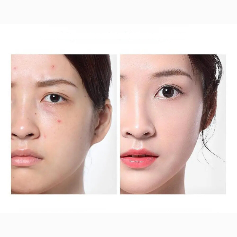 SerenitySkin | Acne-Toner med Klarhed og Langvarig Hydrering Nuvenci.dk